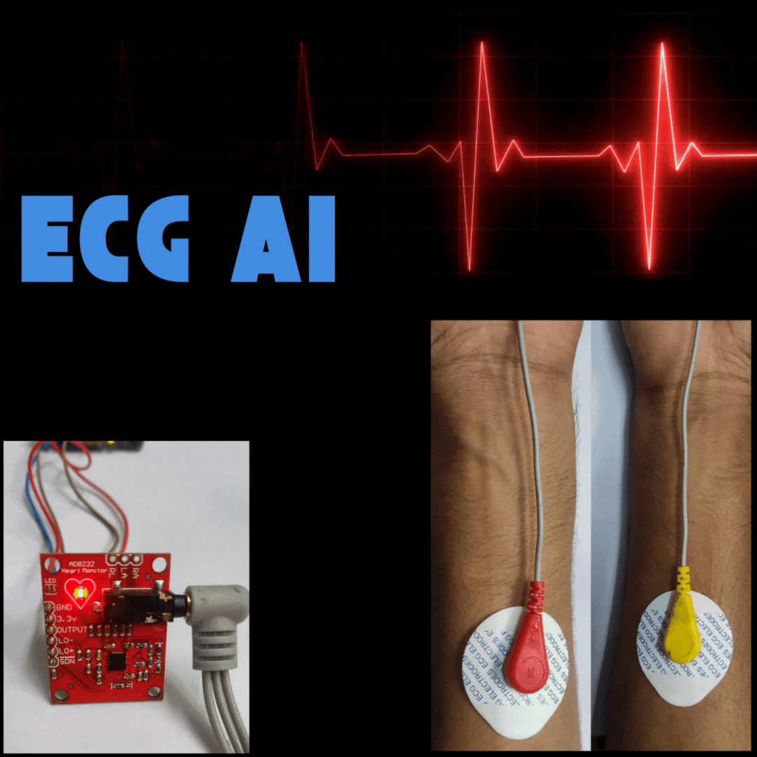 ECG AI: An intelligent System for cardiac health monitoring
